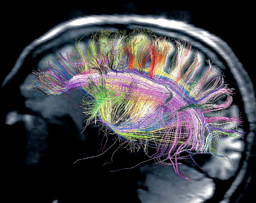 progetto USA di mappatura completa del cervello umano (100 miliardi di neuroni...)