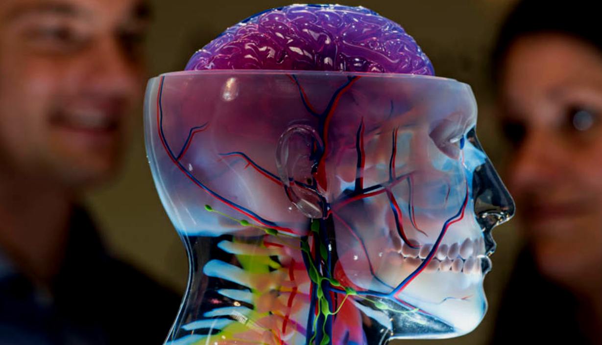 modello, "stampato" in 3D a scopo medico; fonte Meyer