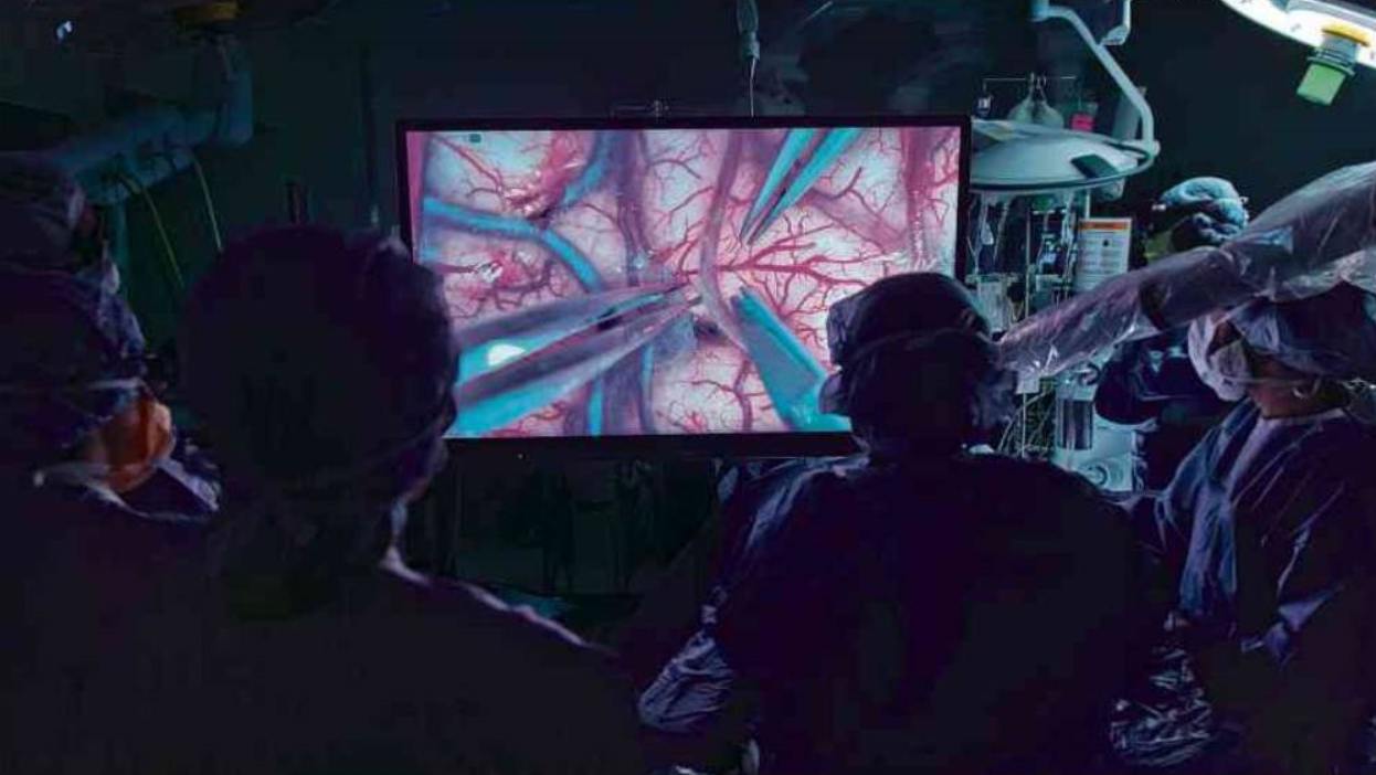 in USA operazione al cervello con VideoMicroscopio 3D; fonte TNYT